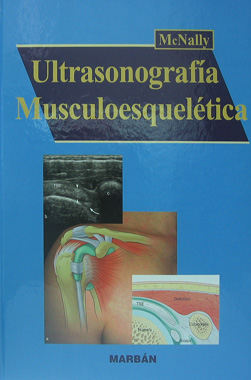 Ultrasonografia Musculoesqueletica