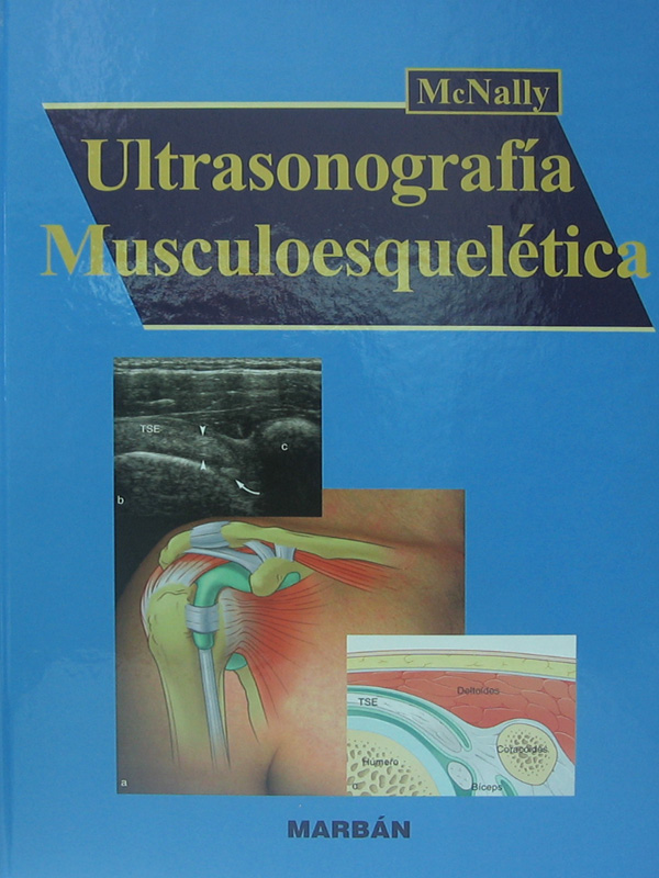 Libro: Ultrasonografia Musculoesqueletica Autor: McNally