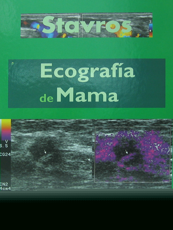 Libro: Ecografia de Mama Autor: A. Thomas Stavros