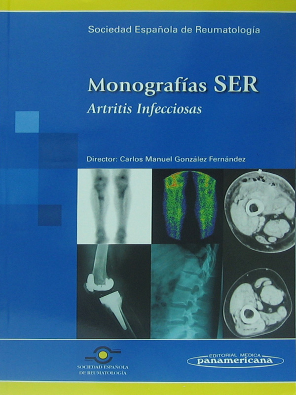 Libro: Monografias SER, Artritis Infecciosas Autor: Sociedad Espa±ola de Reumatologia, Carlos Manuel Gonzales Fernandez