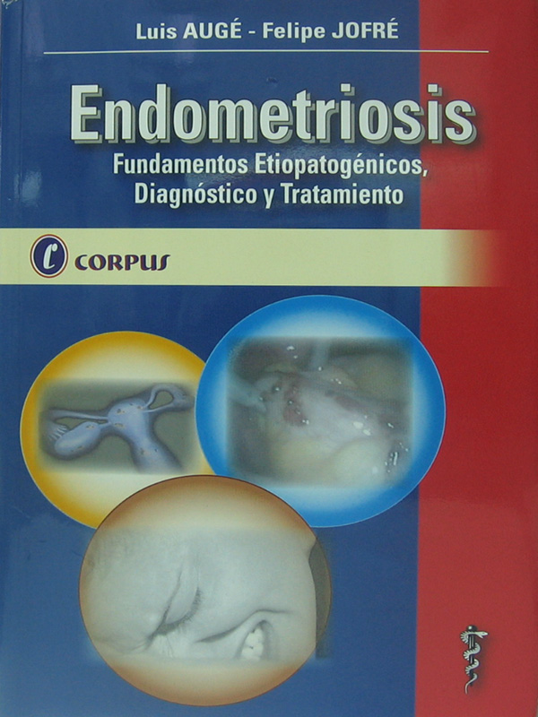 Libro: Endometriosis, Fundamentos Etiopatogenicos, Diagnostico y Tratamiento Autor: Luis Auge, Felipe Jofre