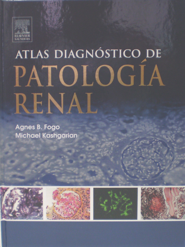 Libro: Atlas Diagnostico de Patologia Renal Autor: Agnes B. Fogo, Michael Kashgarian