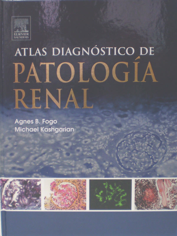 Libro: Atlas Diagnostico de Patologia Renal Autor: Agnes B. Fogo, Michael Kashgarian
