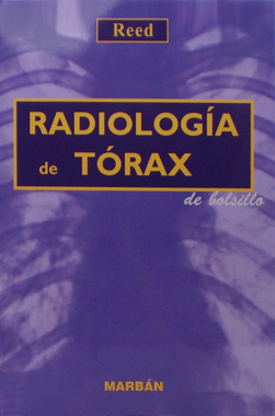 Radiologia de Torax de Bolsillo