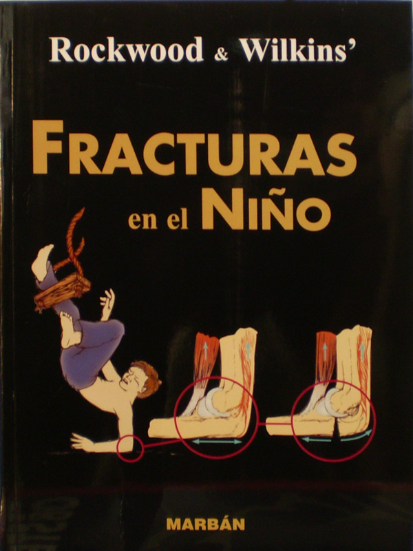 Libro: Fracturas en el Niño de Residente Autor: Rockwood & Wilkins'