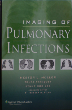 Imaging of Pulmonary Infections