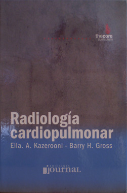 Radiologia Cardiopulmonar