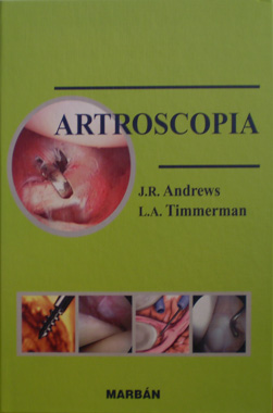 Artroscopia