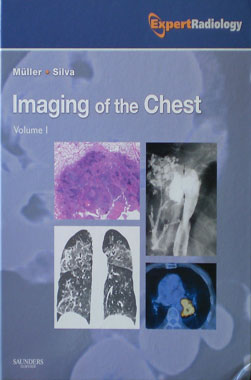 Imaging of the Chest 2 Volumenes Set Expert Radiology