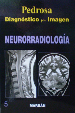 Diagnostico por Imagen Neurorradiologia T.D.