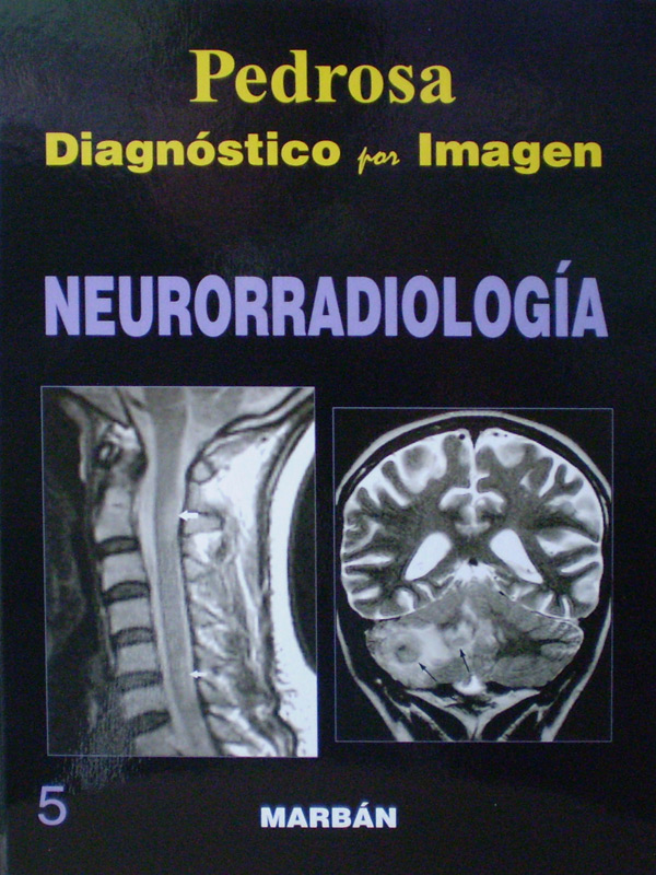 Libro: Diagnostico por Imagen Neurorradiologia T.D. Autor: Pedrosa 5