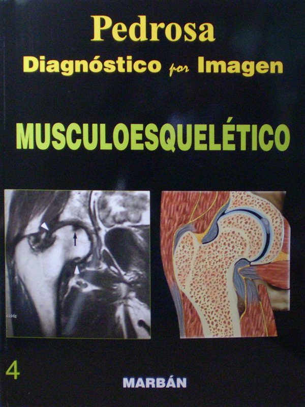 Libro: Flexilibro Diagnostico por Imagen Musculoesqueletico Autor: Pedrosa 4