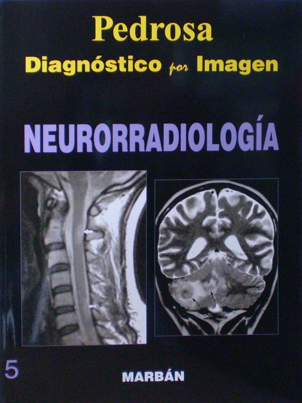 Libro: Flexilibro Diagnostico por Imagen Neurorradiologia Autor: Pedrosa 5