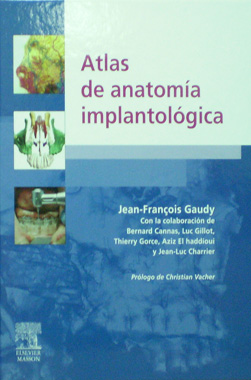 Atlas de Anatomia Implantologica