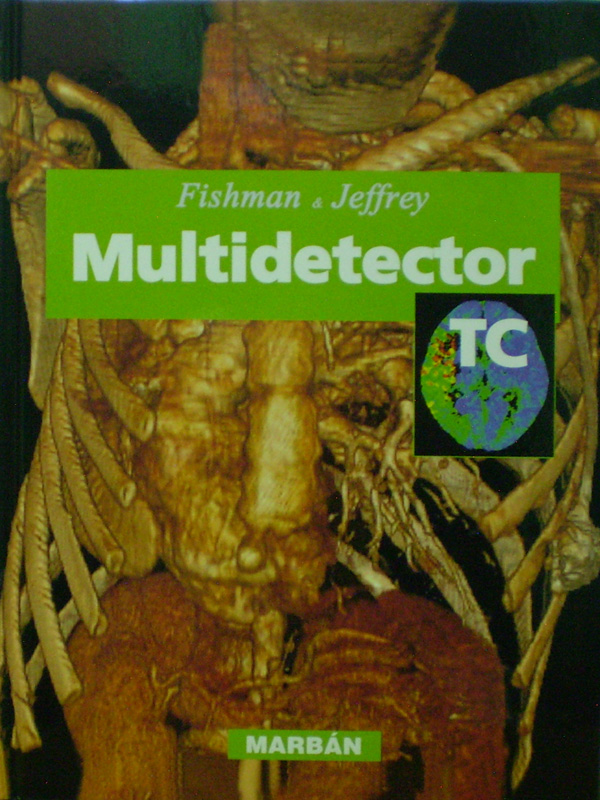 Libro: Multidetector TC Flexilibro Autor: Fishman