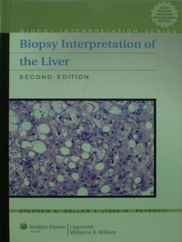 Libro: Biopsy Interpretation of the Liver 2nd. Ed.  Autor: Stephen  A. Geller