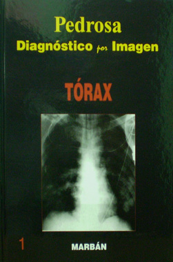 Diagnostico por Imagen Torax Flexilibro