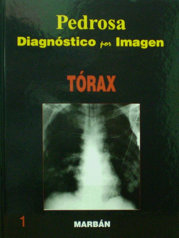 Libro: Diagnostico por Imagen Torax TD Autor: Pedrosa 1