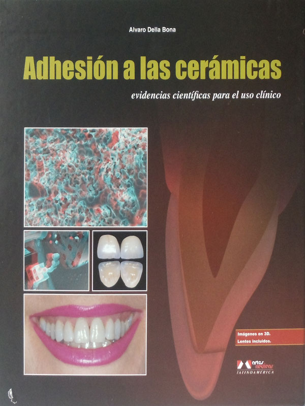 Libro: Adhesion a las Ceramicas, Evidencias Cientificas para el uso Clinico Autor: Alvaro Della Bona