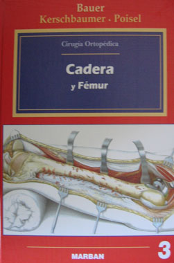 Cadera y Femur  (Cirugia Ortopedica)