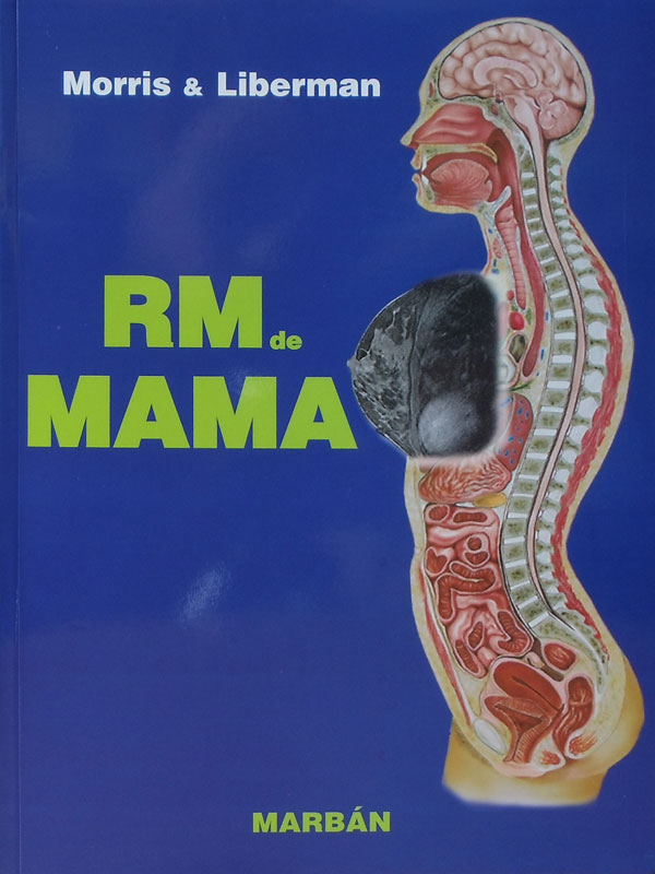 Libro: RM de Mama Autor: Morris, Liberman