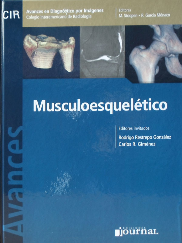 Libro: Avances en el Diagnostico por Imagenes, Musculoesqueletico Autor: M. Stoopen, R. Garcia Monaco