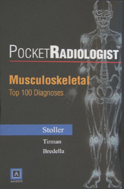Pocket Radiologist-Musculoskeletal: Top 100 Diagnoses