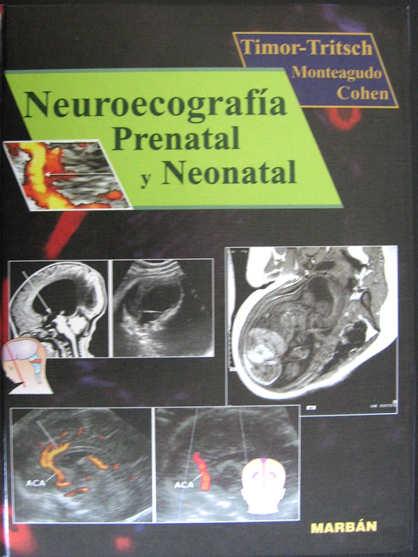Libro: Neuroecografia Prenatal y Neonatal Autor: Timor