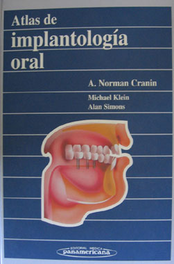 Atlas de Implantologia Oral