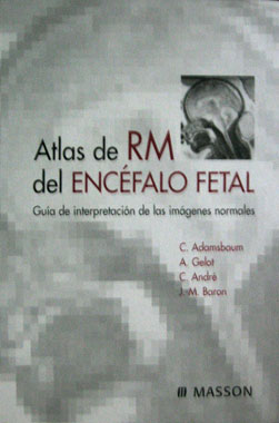 Atlas RM del Encefalo Fetal