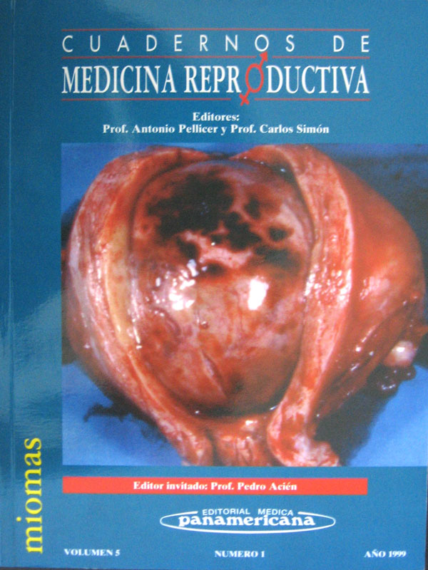 Libro: Miomas Autor: Cuadernos de Medicina Reproductiva