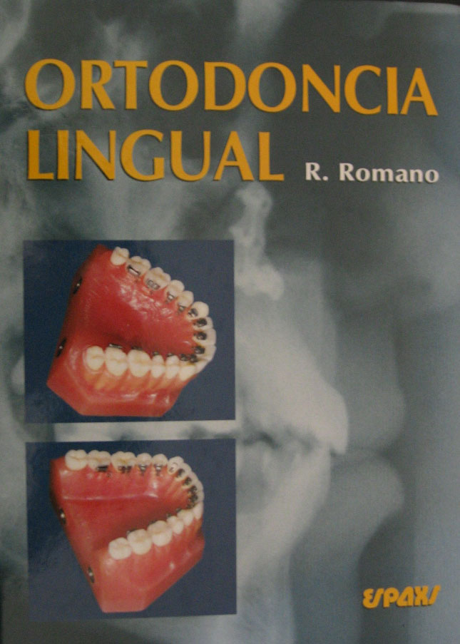 Libro: Ortodoncia Lingual Autor: Romano