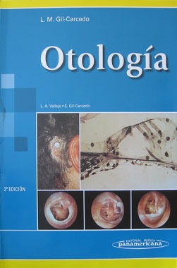 Otologia, 2a. Edicion