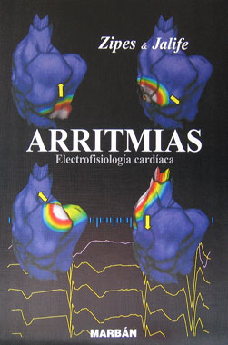 Arritmias Electrofisiologia Cardiaca