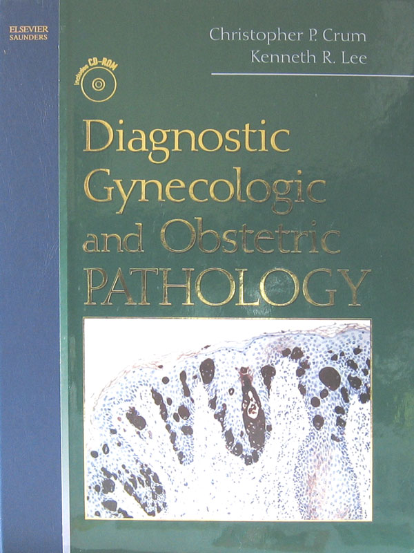 Libro: Diagnostic Gynecologic and Obstetric Pathology Autor: Christopher P. Crum, Kenneth R. Lee
