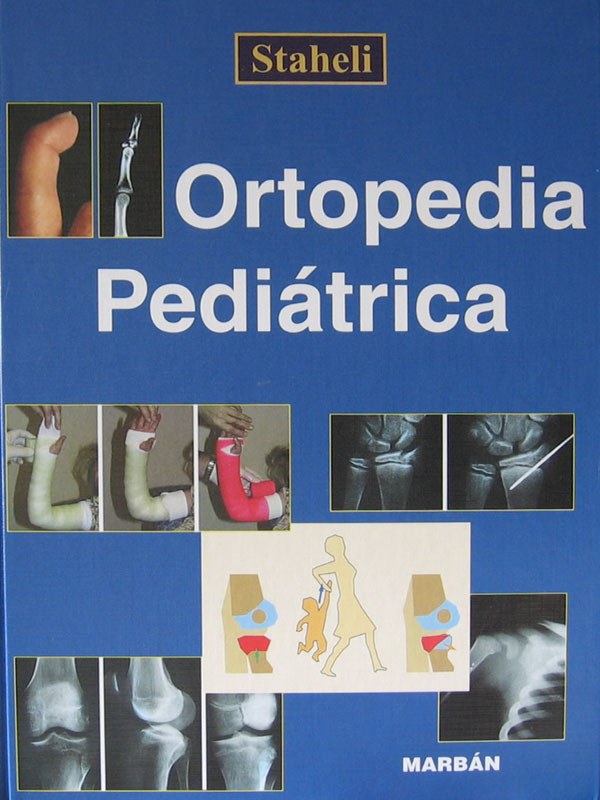 Libro: Ortopedia Pediatrica Autor: Staheli