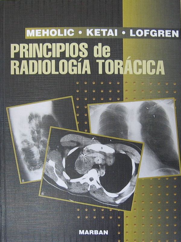 Libro: Principios de Radiologia Toracica Autor: Meholic, Ketai, Lofgren