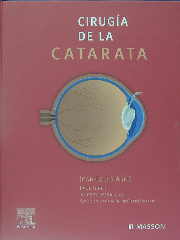 Libro: Cirugia de la Catarata Autor: Jean-Louis Arne, Paul Turut, Thierry Amzallag