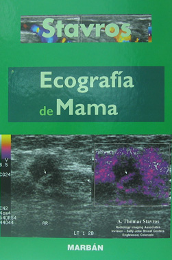 Ecografia de Mama