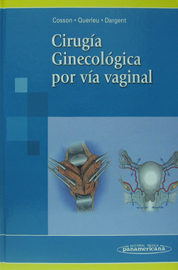 Cirugia Ginecologica por Via Vaginal