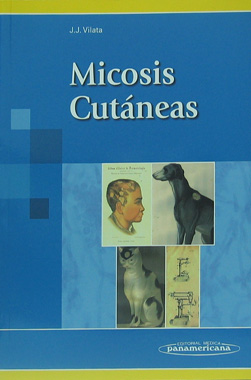 Micosis Cutaneas
