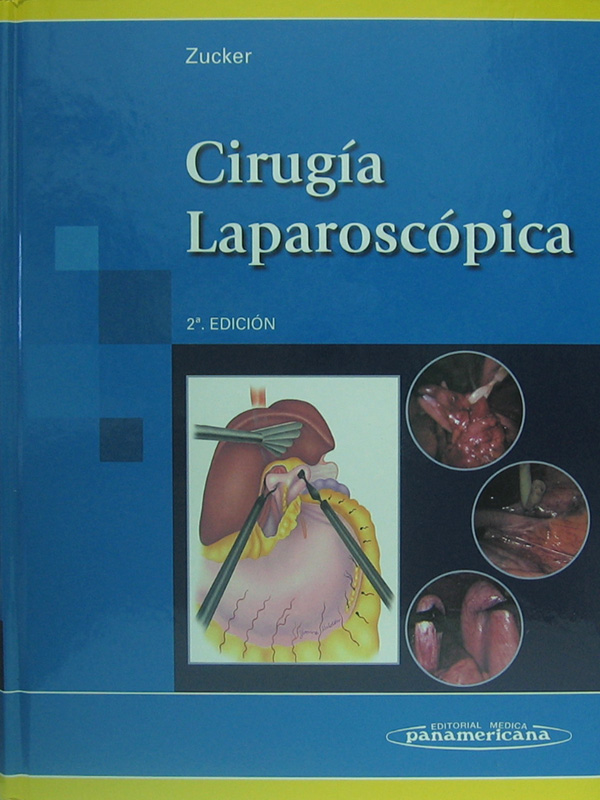 Libro: Cirugia Laparoscopica, 2a. Edicion Autor: Zucker