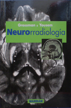 Neurorradiologia de Residente