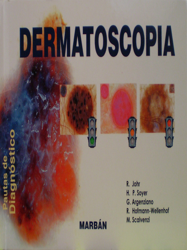 Libro: Dermatoscopia Pautas de Diagnostico Autor: R. Johr
