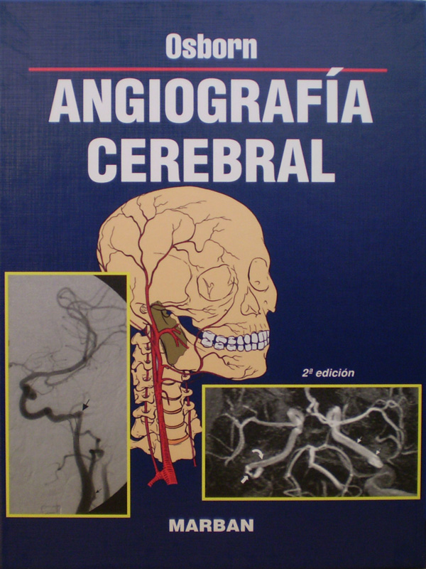 Libro: Angiografia Cerebral 2a. Edicion Autor: Osborn