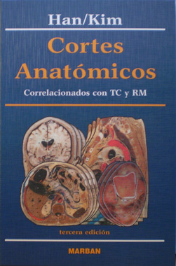 Cortes Anatomicos Correlacionados con TC y RM 3a. Edicion
